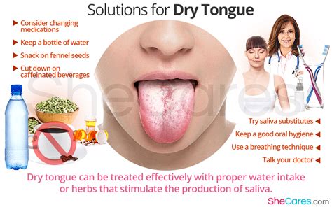 Dry Tongue: Causes and Solutions | SheCares