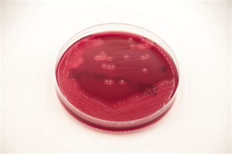 Tryptic Soy Blood Agar - TSBA - Anaerobe Systems