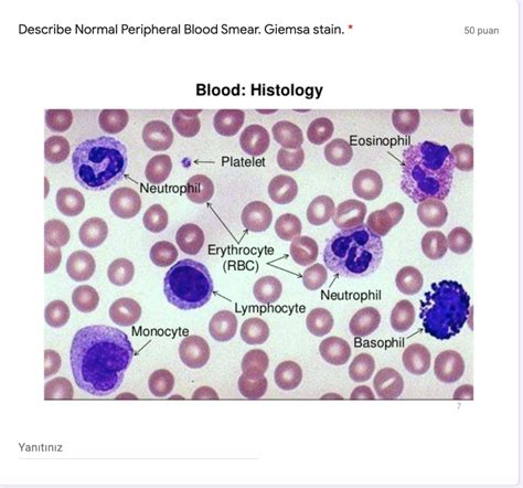 Solved Describe Normal Peripheral Blood Smear. Giemsa stain. | Chegg.com