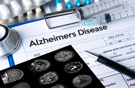 Lecanemab: US FDA approves new ‘breakthrough’ medicine for Alzheimer’s ...