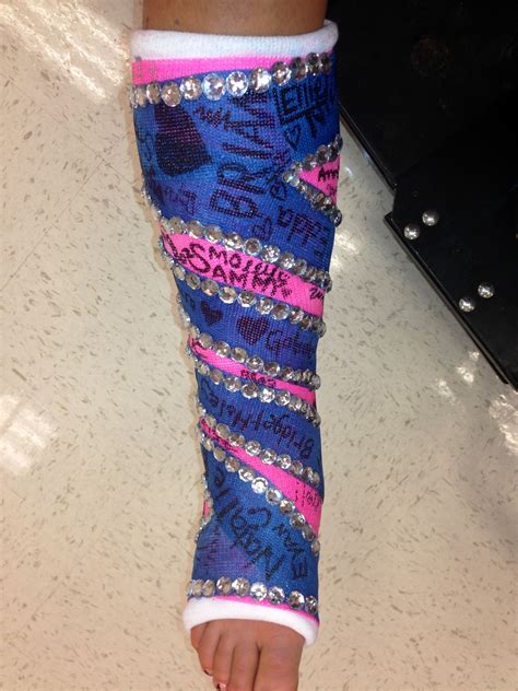 Bedazzled cast Broken Hand Cast, Lisfranc Injury, Gabbs, Achilles Tendon, Leg Cast, Cast Art ...