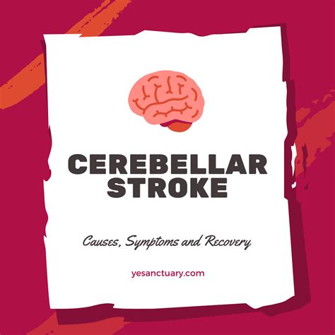 Cerebellar Stroke | Young Earth Sanctuary