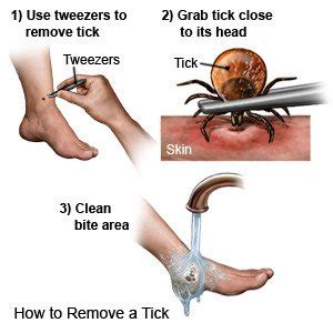 Can Ticks Get Stuck In Dogs Skin