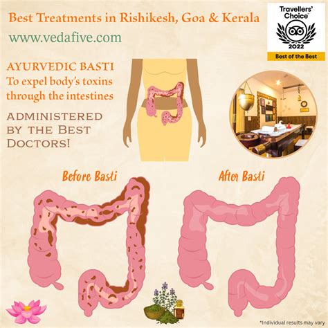 Basti (Medicated Enema Therapy) by Veda5, Best Ayurveda & Yoga Wellness Retreat in Rishikesh ...