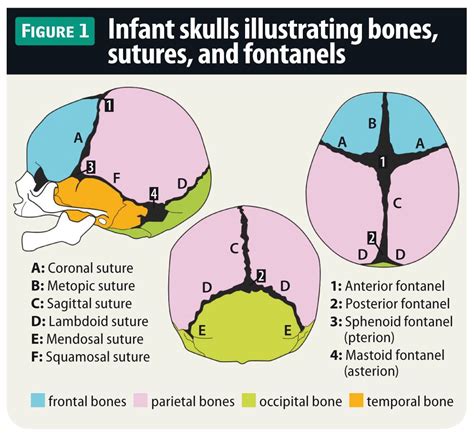 Evaluating fontanels in the newborn skull | Pediatric nursing, Physician assistant school ...