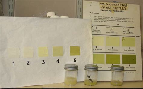 Different Colors Of Sputum