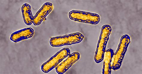 What is listeria? Facts you need to know