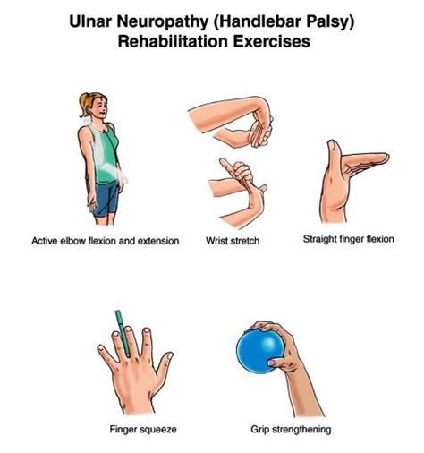 EXCLUSIVE PHYSIOTHERAPY GUIDE FOR PHYSIOTHERAPISTS: EXERCISE FOR ULNAR NERVER INJURY/ULNAR ...