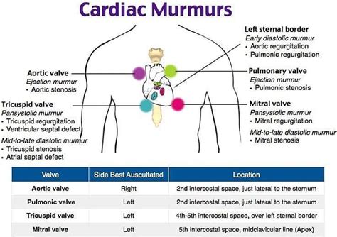 Instagram post by DoctalkDocent • Mar 6, 2019 at 3:39pm UTC Cardiology Nursing, Cardiac Nursing ...