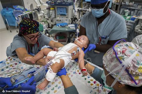 Conjoined Twins Headed Home Separately From Texas Hospital After ...