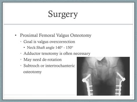 PPT - Developmental Coxa Vara PowerPoint Presentation, free download ...