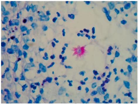 JoF | Special Issue : Sporothrix and Sporotrichosis