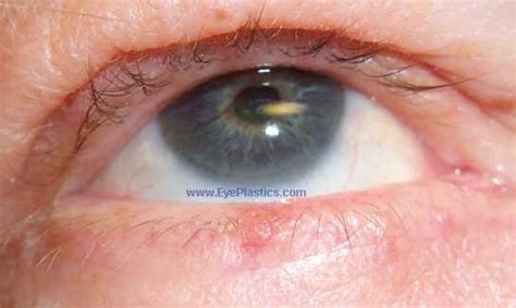 Cosmetic and Reconstructive Surgery of the eyelids, orbits and tear ducts