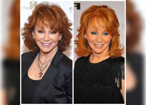 Reba McEntire Plastic Surgery: Did She Undergo Surgery?