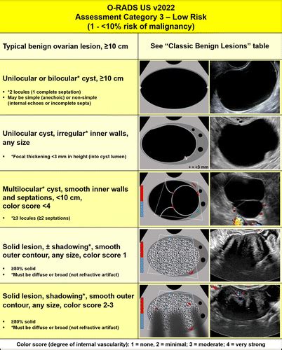 O-RADS US v2022: An Update from the American College of Radiology’s ...