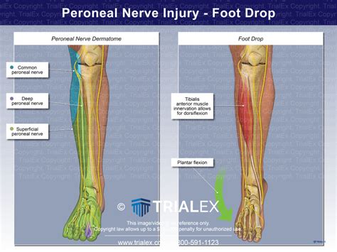 Superficial Peroneal Nerve Block