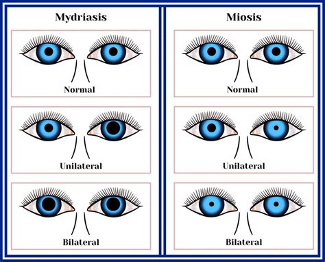 Miosis - Causes, Symptoms & Treatment Options