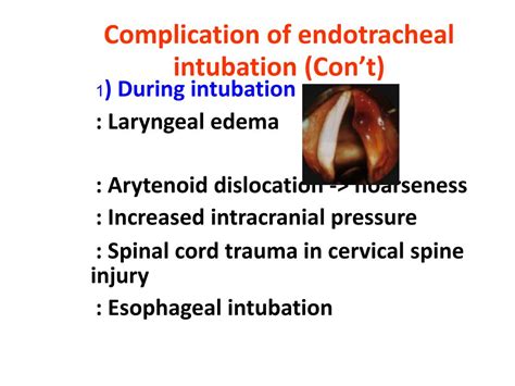 Complications Of Endotracheal Intubation Endotracheal Intubation | Images and Photos finder