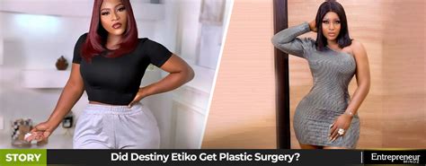 Did Destiny Etiko Get Plastic Surgery: Who Is Destiny Etiko?