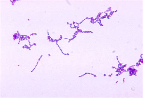 Streptococcus - wikidoc