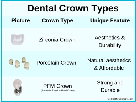 dental crown types
