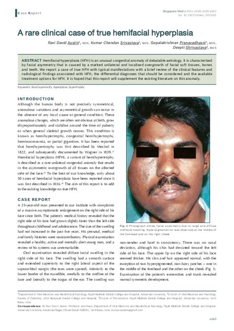 (PDF) A rare clinical case of true hemifacial hyperplasia | Dr Deepti ...