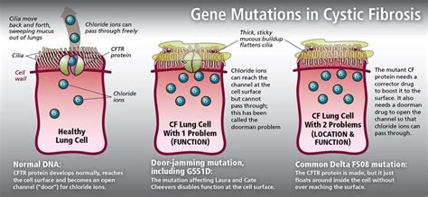 Cystic Fibrosis genetics: Know Your CF Mutations