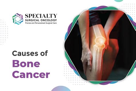 Causes & Types of Bone Cancer | SSO Hospitals