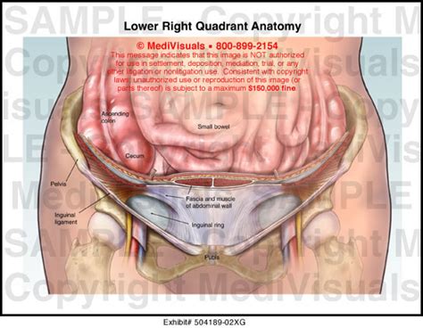 Lower Right Quadrant Anatomy - Medivisuals Inc.