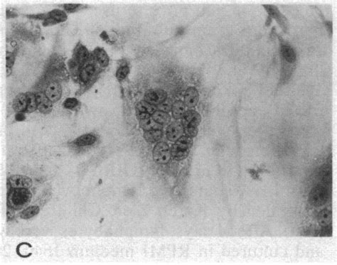 Induction of syncytia in endothelial monolayers by C91/PL cells ...