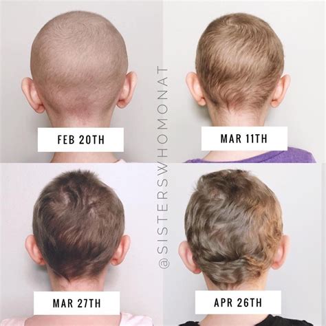 Before and after chemo hair growth - Insane hair growth transformation ...