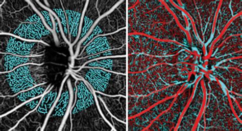 Marrus Adaptive Optics Imaging Laboratory | New York Eye & Ear