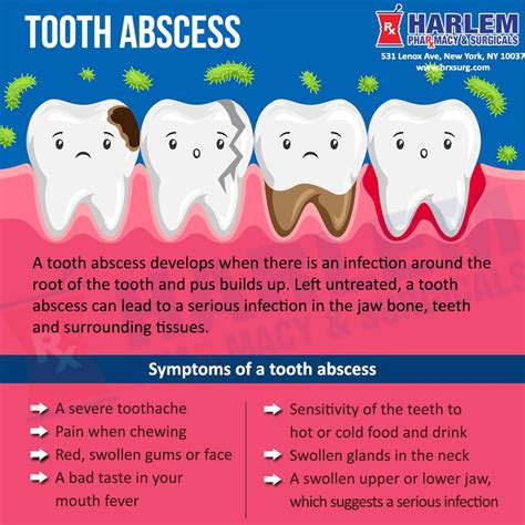 Causes Of Abscess Tooth