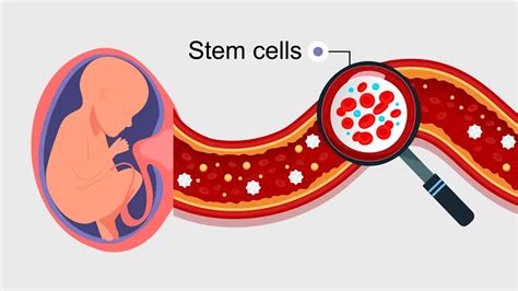 From Curing Cancer To Reversing Paralysis: Doctor Explains The Role of Stem Cells In ...