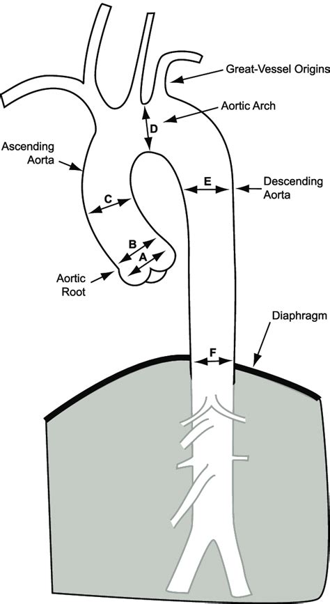 This diagram of the thoracic aorta demonstrates the segments used for... | Download Scientific ...