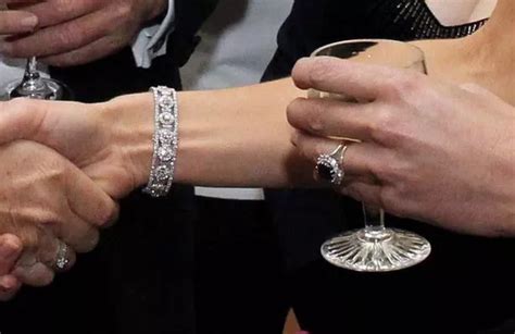 Duchess of Cambridge Kate has scar on head from serious injury as a ...