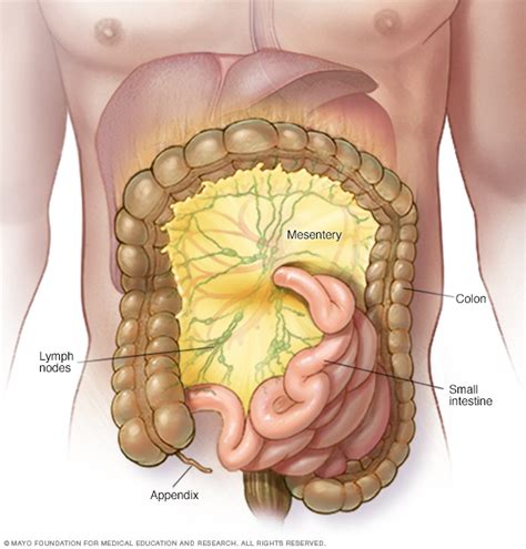 Mesenteric lymphadenitis | Sparrow