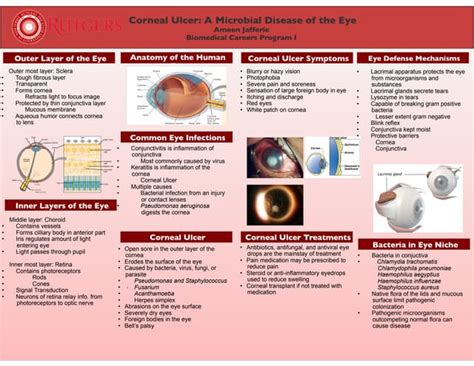 Microbial Diseases of the Eye | PPT | Free Download