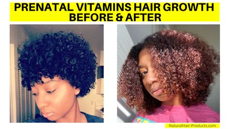 SEE Prenatal Vitamins Hair Growth Before and After Pictures [NOW]