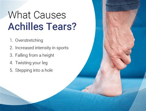 Achilles Tendon Tear in Houston, TX