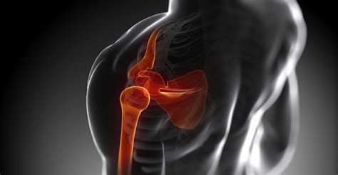 Shoulder Joint Replacement Midwest City | Shoulder Pain | Shoulder Arthritis Oklahoma City