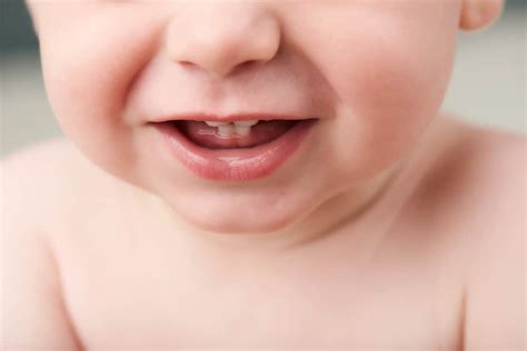 Problems From Baby Teeth Coming in - Triangle Pediatric Dentistry