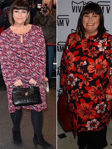 Dawn French weight loss: How Little Big Shots host lost EIGHT stone ...