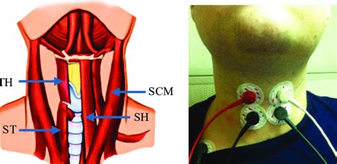 Strap Muscle Of Neck - Human Anatomy