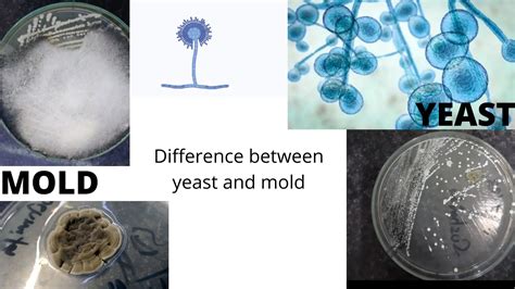 Difference Between Yeast and Mold • Microbe Online