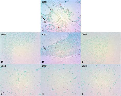 TUNEL staining in the brain cortex (400x) and cerebellum (200x) tissues... | Download Scientific ...