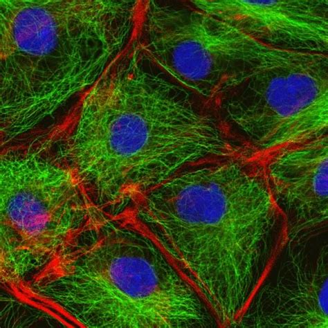 Plant Life: Cytoskeleton