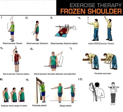 Santa Barbara Massage Blog: How You Can Effectively Treat Frozen Shoulder (Capsuli… | Shoulder ...