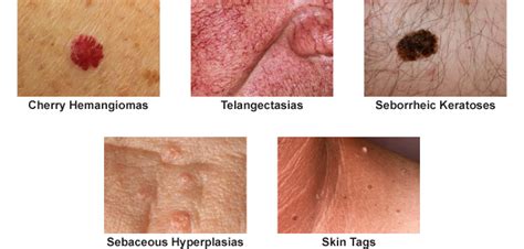 Treatment for Aging Skin Orlando | Associates In Dermatology