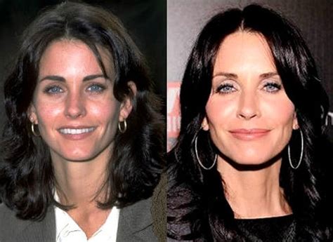 Courteney Cox Plastic Surgery Speculations Have Been Confirmed